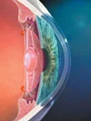 Near vision